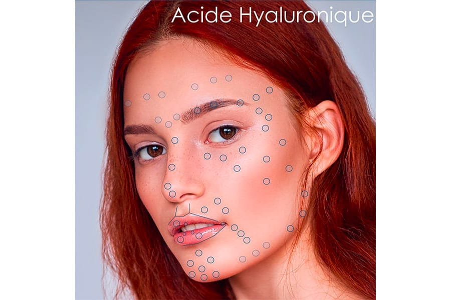 biostimulation cutanee chirurgie visage medecine esthetique paris docteur philippe pelissier chirurgien plasticien esthetique paris