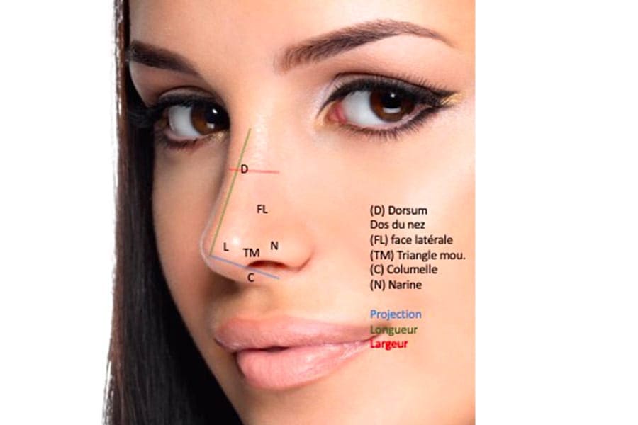 abdominoplastie un an apres chirurgie ventre chirurgie esthetique paris dr philippe pelissier chirurgien plasticien esthetique paris