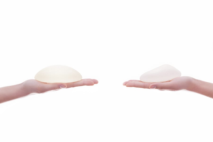 abdominoplastie un an apres chirurgie ventre chirurgie esthetique paris dr philippe pelissier chirurgien plasticien esthetique paris